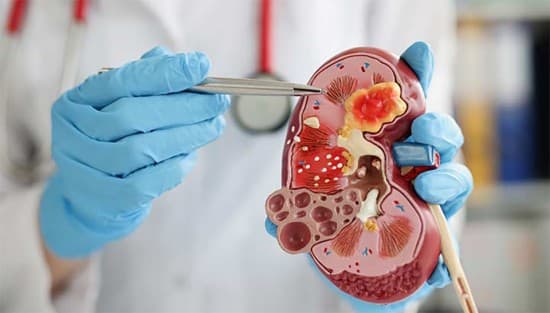 Hand_book_Nephrology