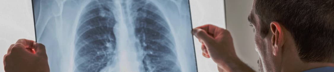 جامع عکس قفسۀ سینه